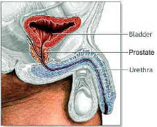 Prostate Tumor Breast Cancer – Causes Symptoms and Treatment