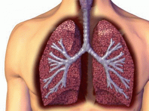 Mesothelioma-and-Asbestos-Lung-Cancer Mesothelioma and Asbestos Lung Cancer 300x225 Lung Mesothelioma Asbestos