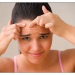 Cystic Acne 150x150 How To Get Rid Of Acne Scars Fast